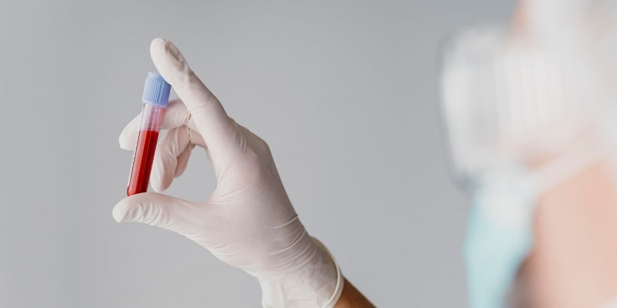 síntomas de la hemofilia ante la falta de coagulación de sangre