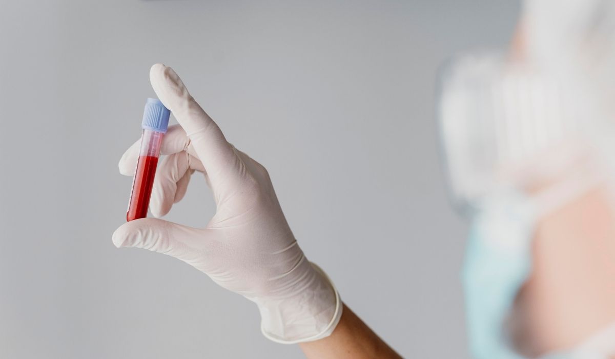 síntomas de la hemofilia ante la falta de coagulación de sangre