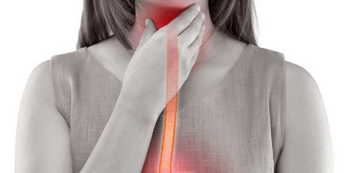 esofago-barret-blog causalidades del esófago de barret