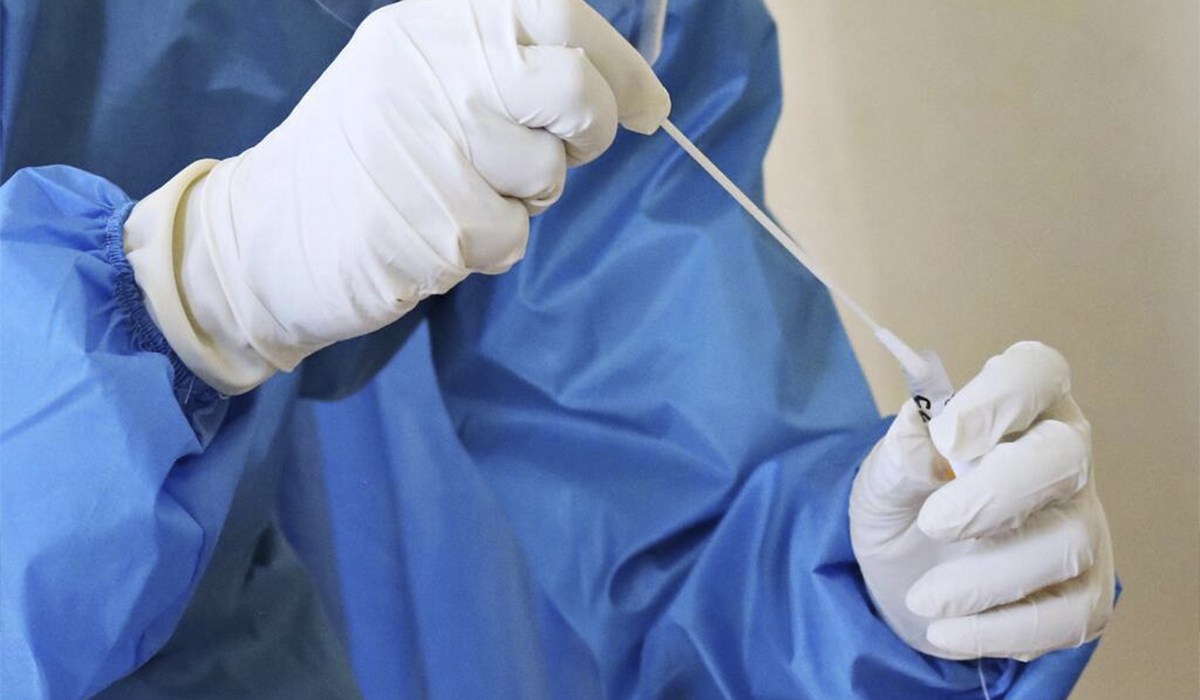 viruela_del mono viruela del mono