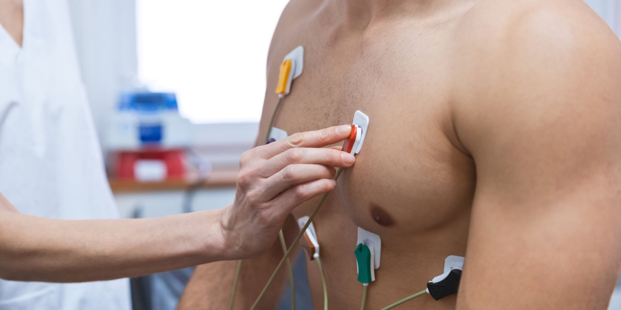 Aprende Cómo Realizar la Colocación de Electrodos en un ECG