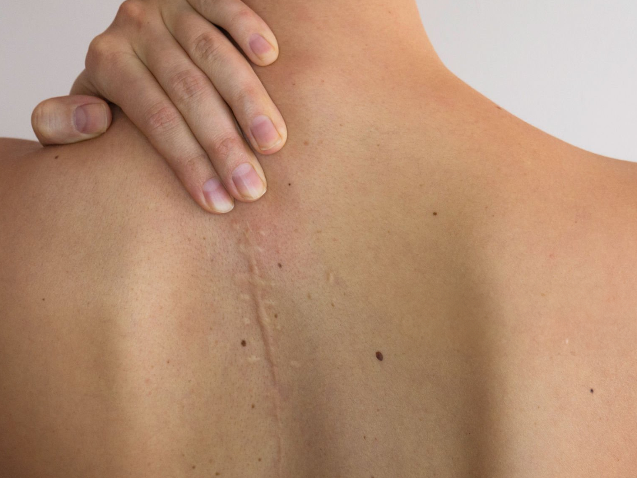 fase de cicatrización Fase de cicatrización: guía completa para enfermería