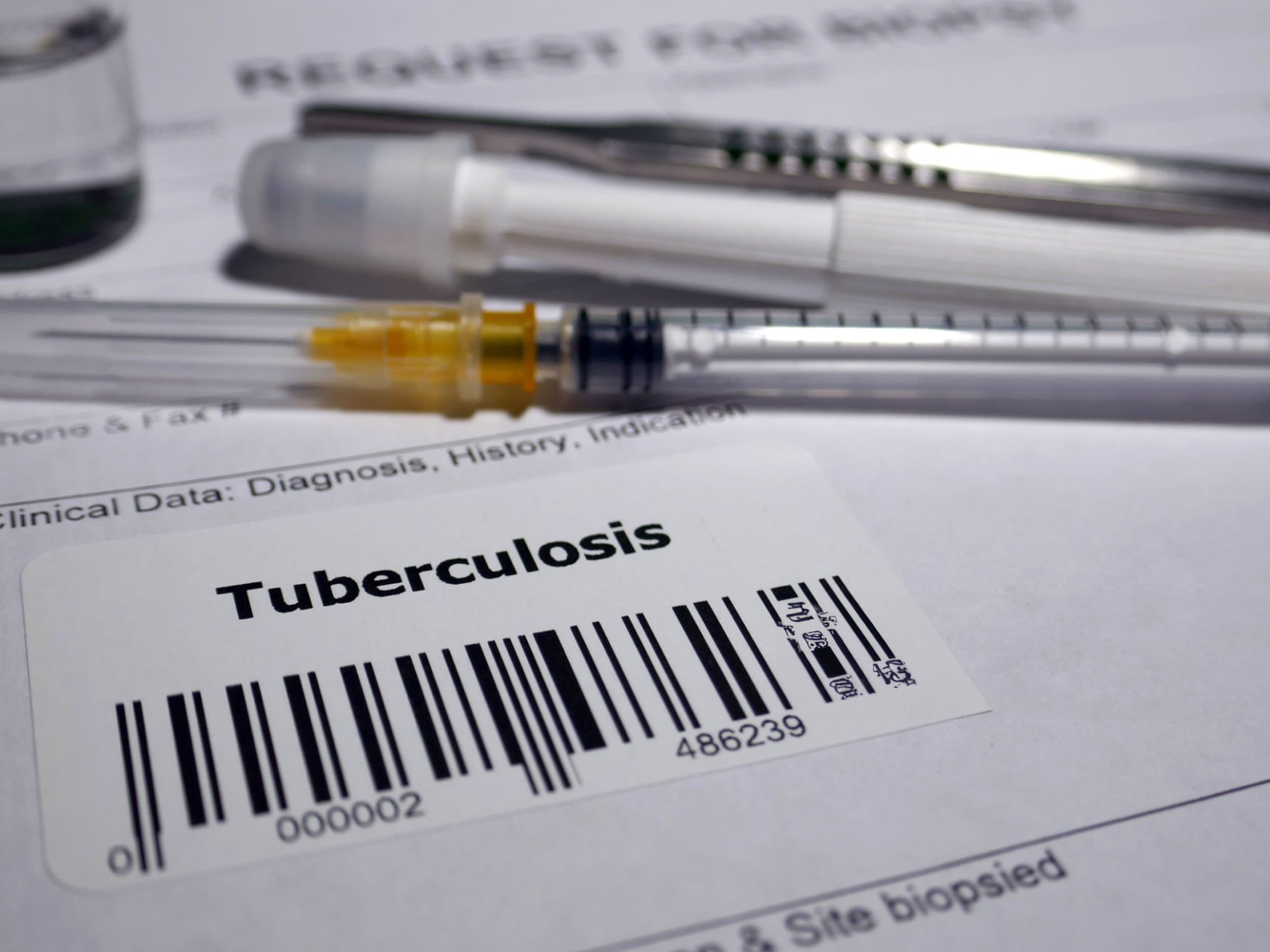 prueba de mantoux La prueba de Mantoux es vital en la detección de TB. Conoce su procedimiento y resultados en nuestra guía para enfermeros y enfermeras.